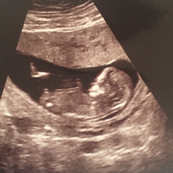 October 2016 (thread number four). Entering the second trimester.