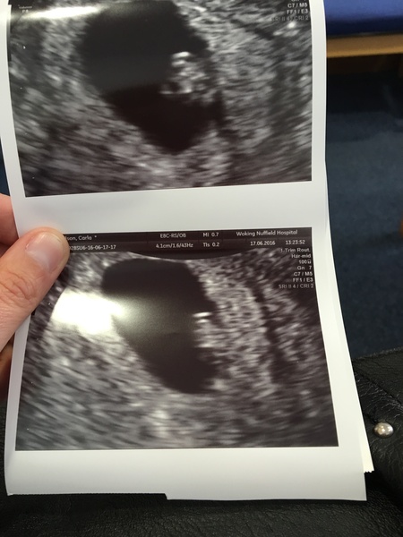 Due in February 2017...thread #2!