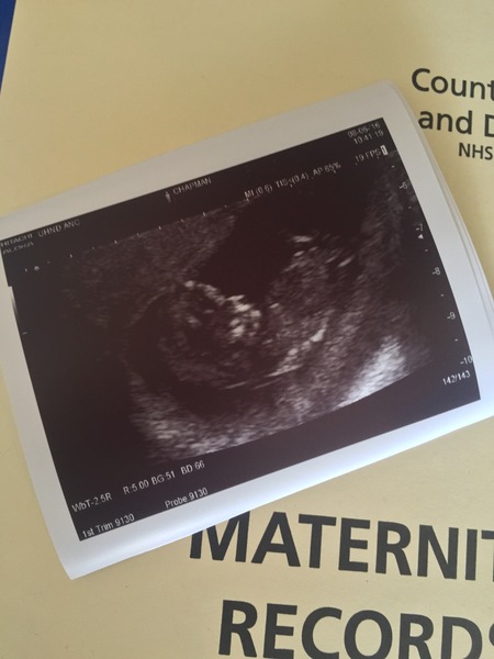 December 2016 babies... 2nd trimester in sight