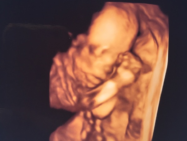 Thread #6 - TTC#1 Grads - Sun roasted pregnant ladies