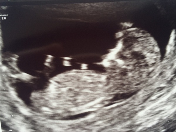 December 2016 babies... 2nd trimester in sight