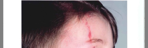 help what could this be caused by? maybe at nursery
