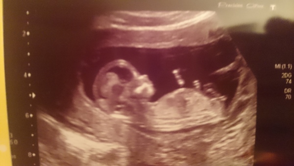 December 2016 babies... 2nd trimester in sight