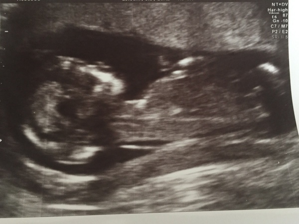 December 2016 babies... 2nd trimester in sight