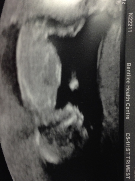 December 2016 babies... 2nd trimester in sight