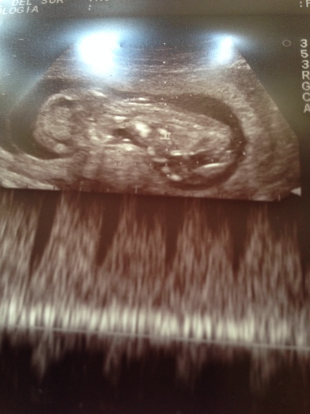 December 2016 babies... 2nd trimester in sight