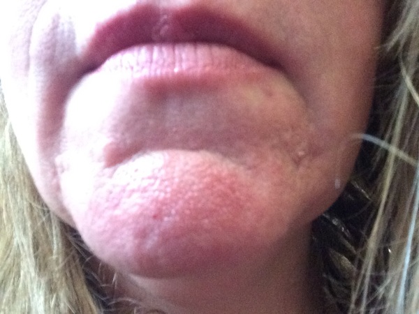 Help me to sort my skin out!
