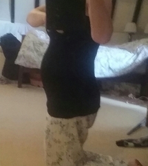 Shrinking bump...with pics!