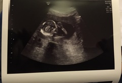 Babies due in November 2016 #4