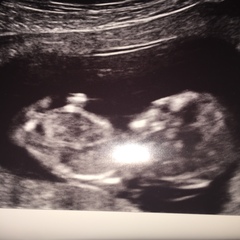 My nub!