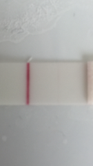 Cramps in early pregnancy. Is a burning sensation normal?