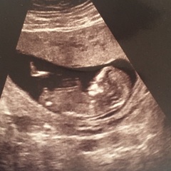 Any thoughts on this scan! (Find out the gender next Wednesday!)