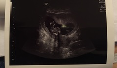 Babies due in November 2016 #4