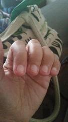 Really need the ultimate nail help plan