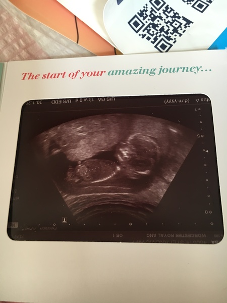 12 week scan - boy or girl?
