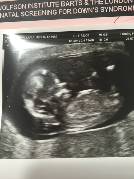 February 2017 - Thread 4 (are we the chattiest bunch or what?!)