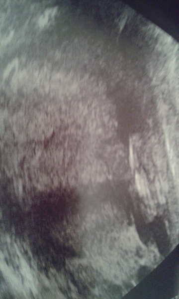 is this a potty shot? scan pic 20plus3, boy or girl?