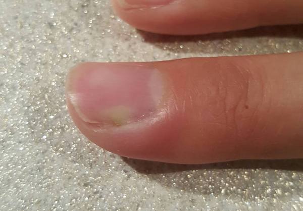 Er, my finger looks like it is going green. <pic!>