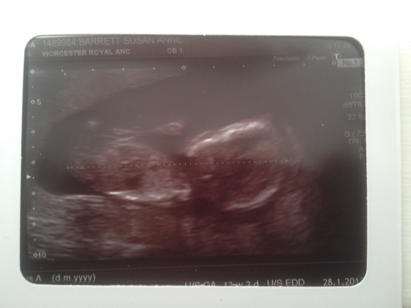 February 2017 - Thread 4 (are we the chattiest bunch or what?!)