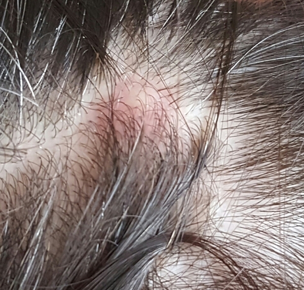 My head is killing me!!!