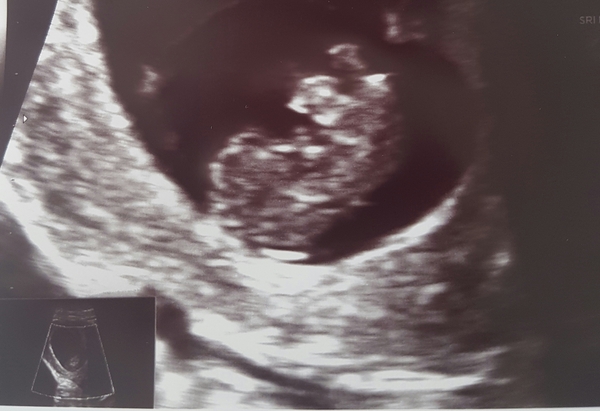 Staying posifrickentive- Thread 9 for ladies pg after mc