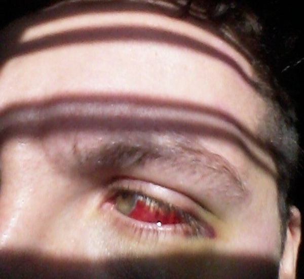 to think dh needs to see a doctor? pic, sorry
