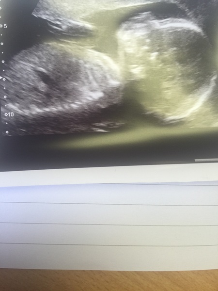 Thread #9 - TTC#1 grads thread - it's the final countdown