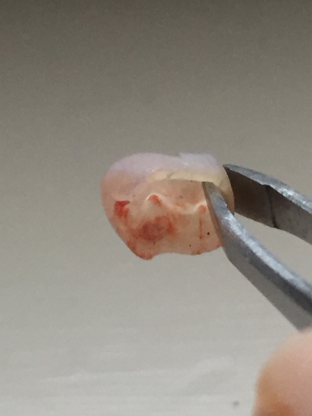 Any children's dentists around, please?