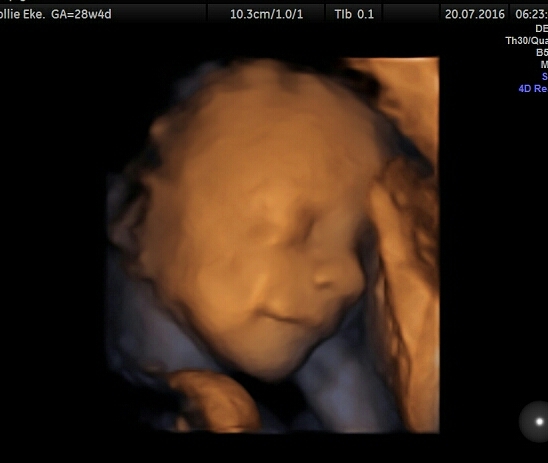 Thread #9 - TTC#1 grads thread - it's the final countdown