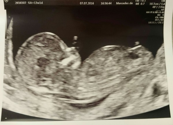 Thread #8 - TTC#1 Grads - stripy bump photos ahoy!