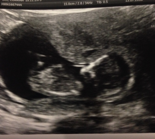 February 2017 - Thread 4 (are we the chattiest bunch or what?!)