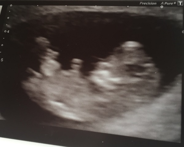 February 2017 - Thread 4 (are we the chattiest bunch or what?!)