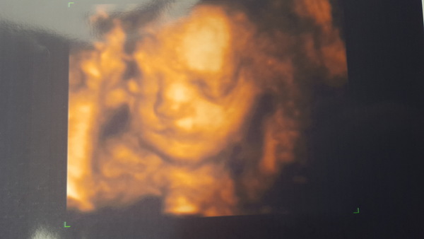 Thread #9 - TTC#1 grads thread - it's the final countdown