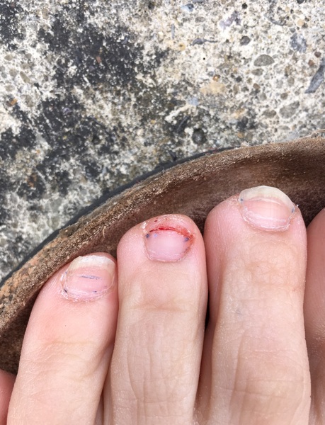 Owwww I just ripped half a toenail off and I was going to get shellac on Monday!