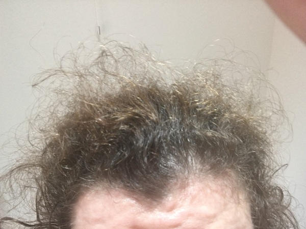 Hair SOS!