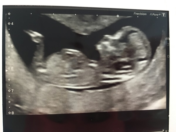 February 2017 - Thread 4 (are we the chattiest bunch or what?!)