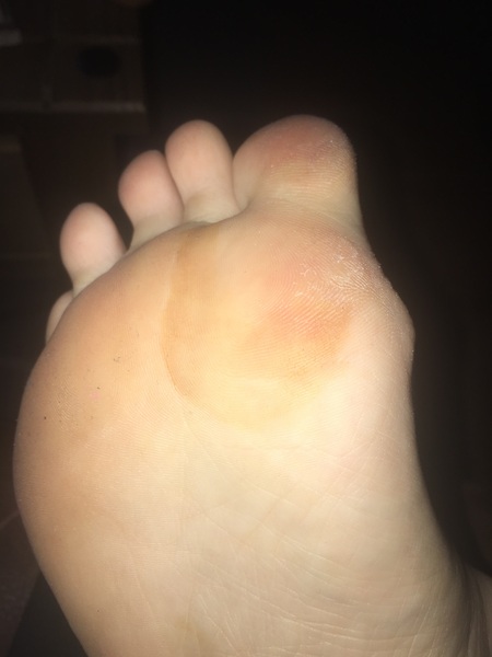 Should I get this checked out?