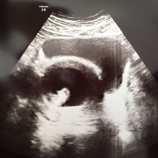 February 2017 - Thread 4 (are we the chattiest bunch or what?!)