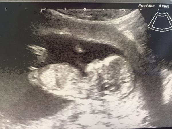 February 2017 - Thread 4 (are we the chattiest bunch or what?!)