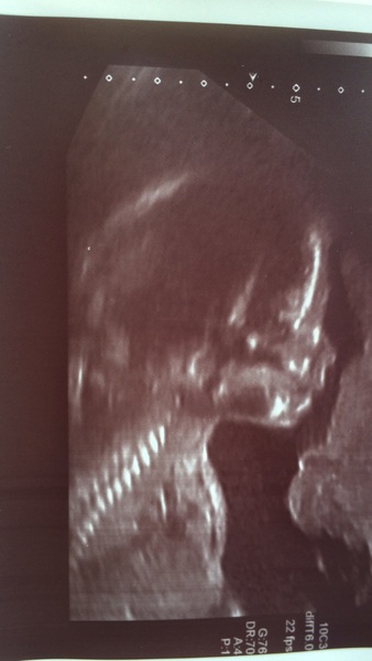 December 2016 babies - thread #4 - blooming in trimester 2!