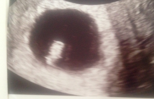 When to expect period - Provera