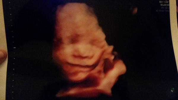3D 4D scan