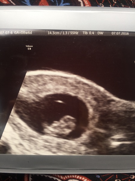 Due in February 2017...thread #3!