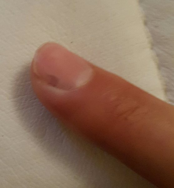 Er, my finger looks like it is going green. <pic!>