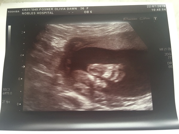 December 2016 babies - thread #4 - blooming in trimester 2!