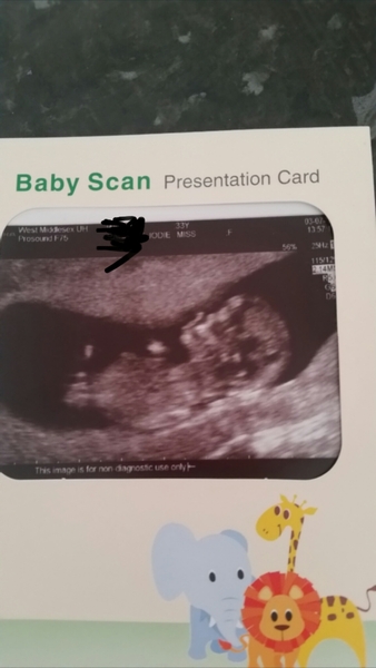 January 2017 babies - Thread #2