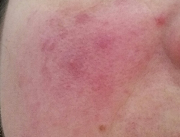 Foundation to cover lots of spots?