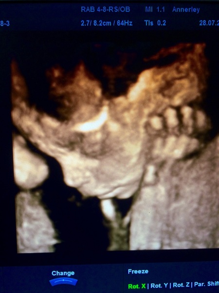 Babies due in November 2016 #5