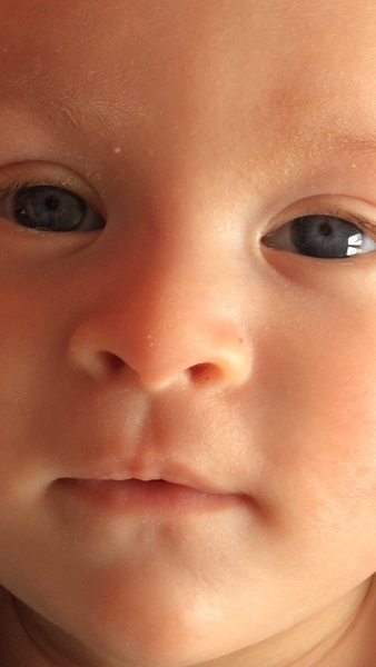 Chromosomal problem?