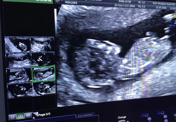 February 2017 - Thread 4 (are we the chattiest bunch or what?!)